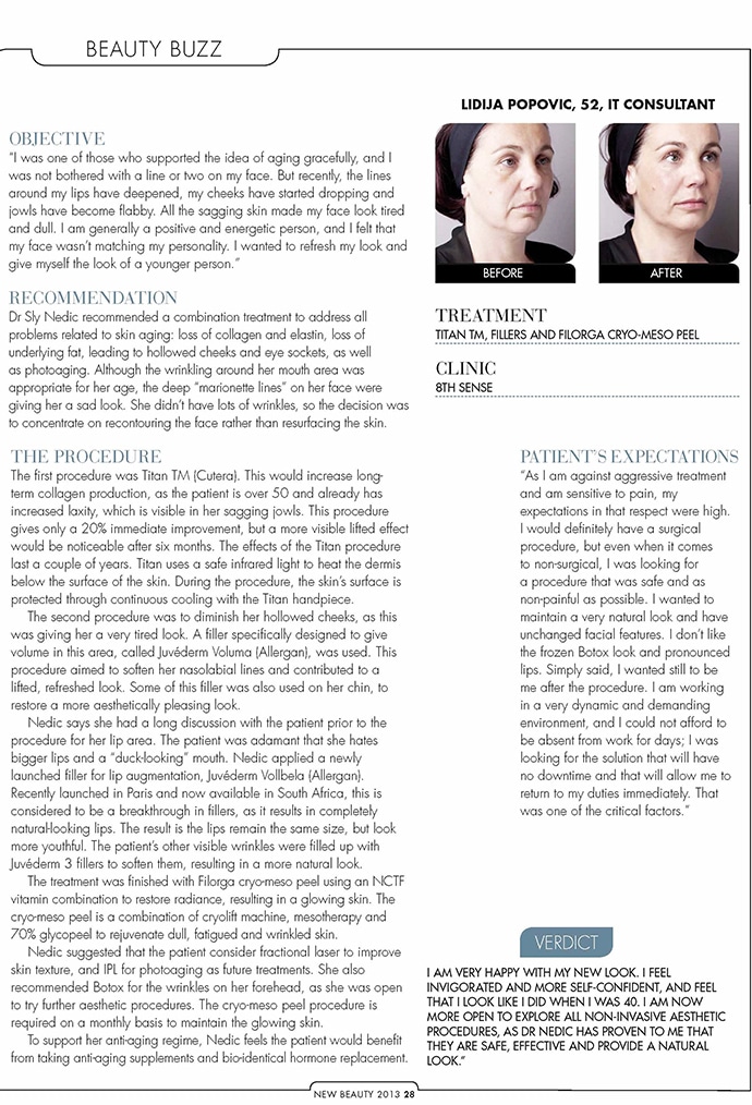 8th Sense -030 facial makeover 002Facial Makeover - Dr. NedicLatest News